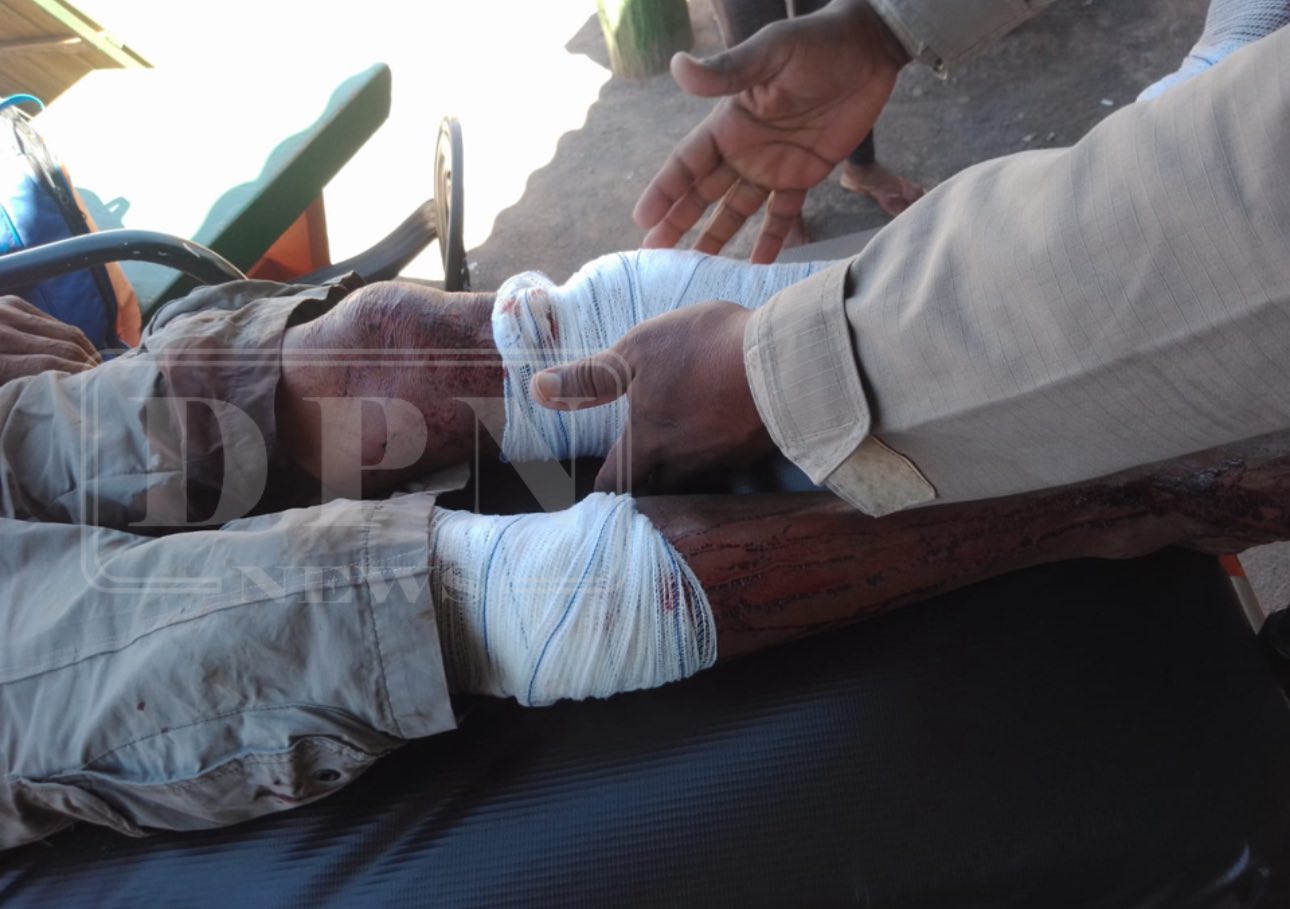 Homem é atacado por cães em frente a conveniência em Corumbá