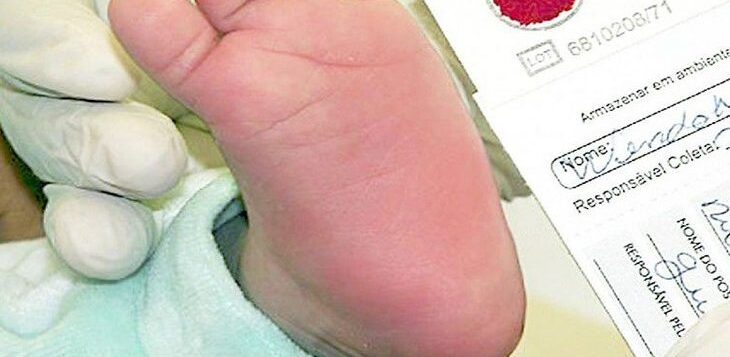 No Dia Mundial da Doença Falciforme, MS lança plano de trabalho para reforçar linha de cuidado e ampliar diagnóstico