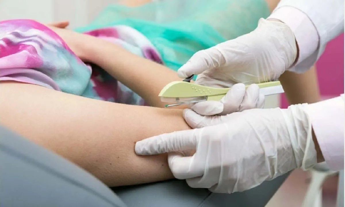 SUS vai oferecer implante contraceptivo que custa até R$ 4 mil gratuitamente