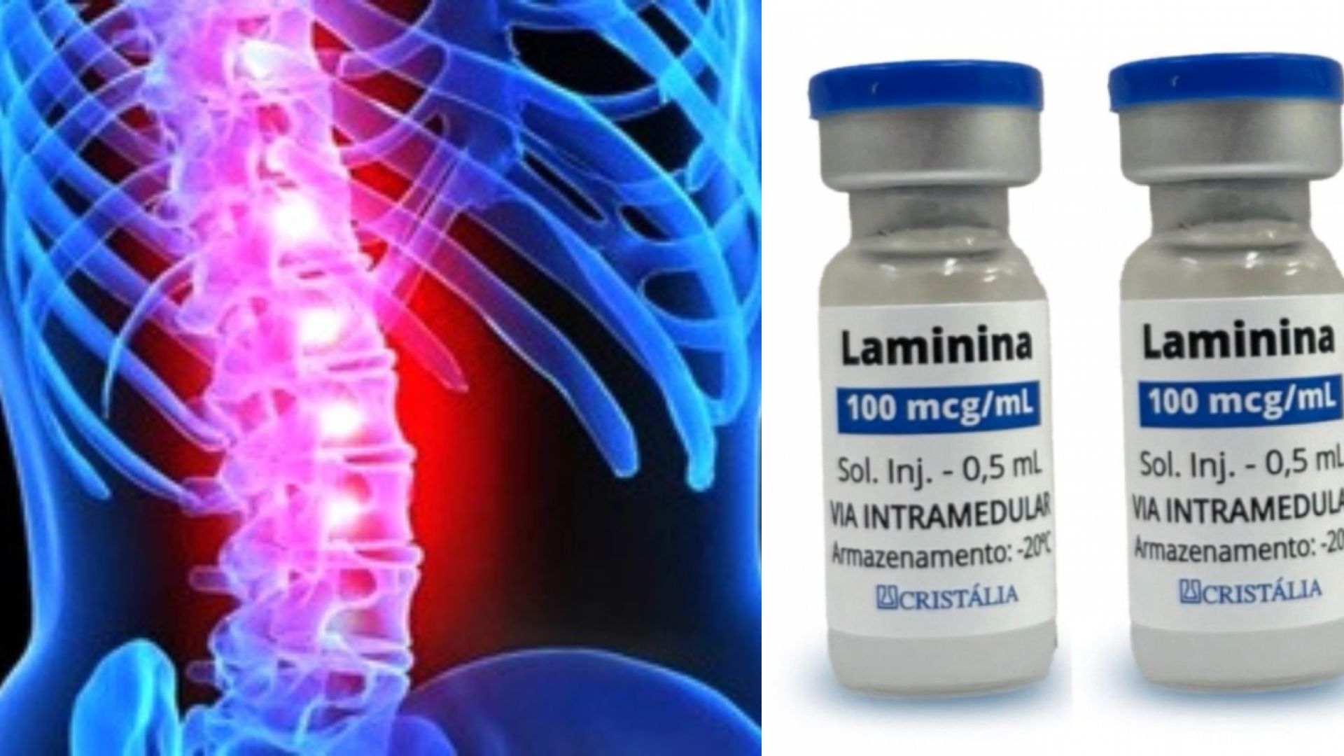 Jovem de MS que ficou tetraplégico aguarda autorização para procedimento com polilaminina