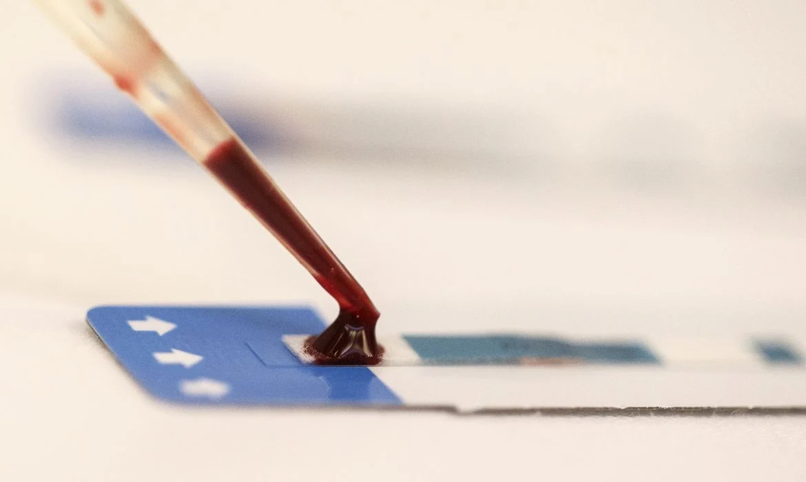 Fiocruz testa PrEP em estudo que busca ampliar prevenção de HIV entre jovens